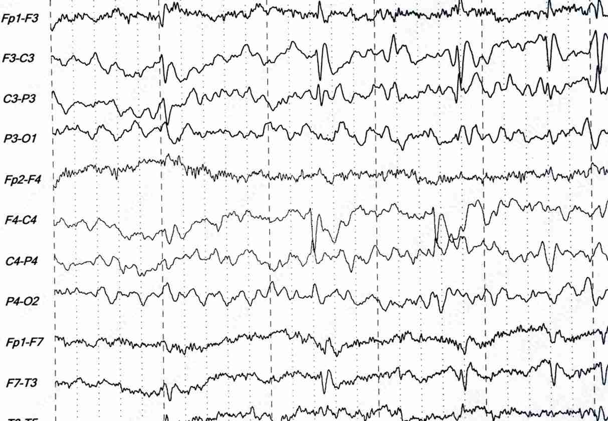 Mobile EEG Reading